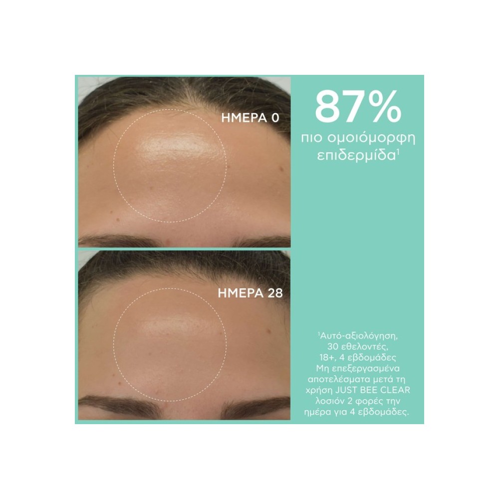 Preview 5 of Apivita Just Bee Clear Λοσιόν Σύσφιξης Πόρων Με Πρόπολη AmC & Φυτικό Σαλικυλικό Οξύ 200ml.