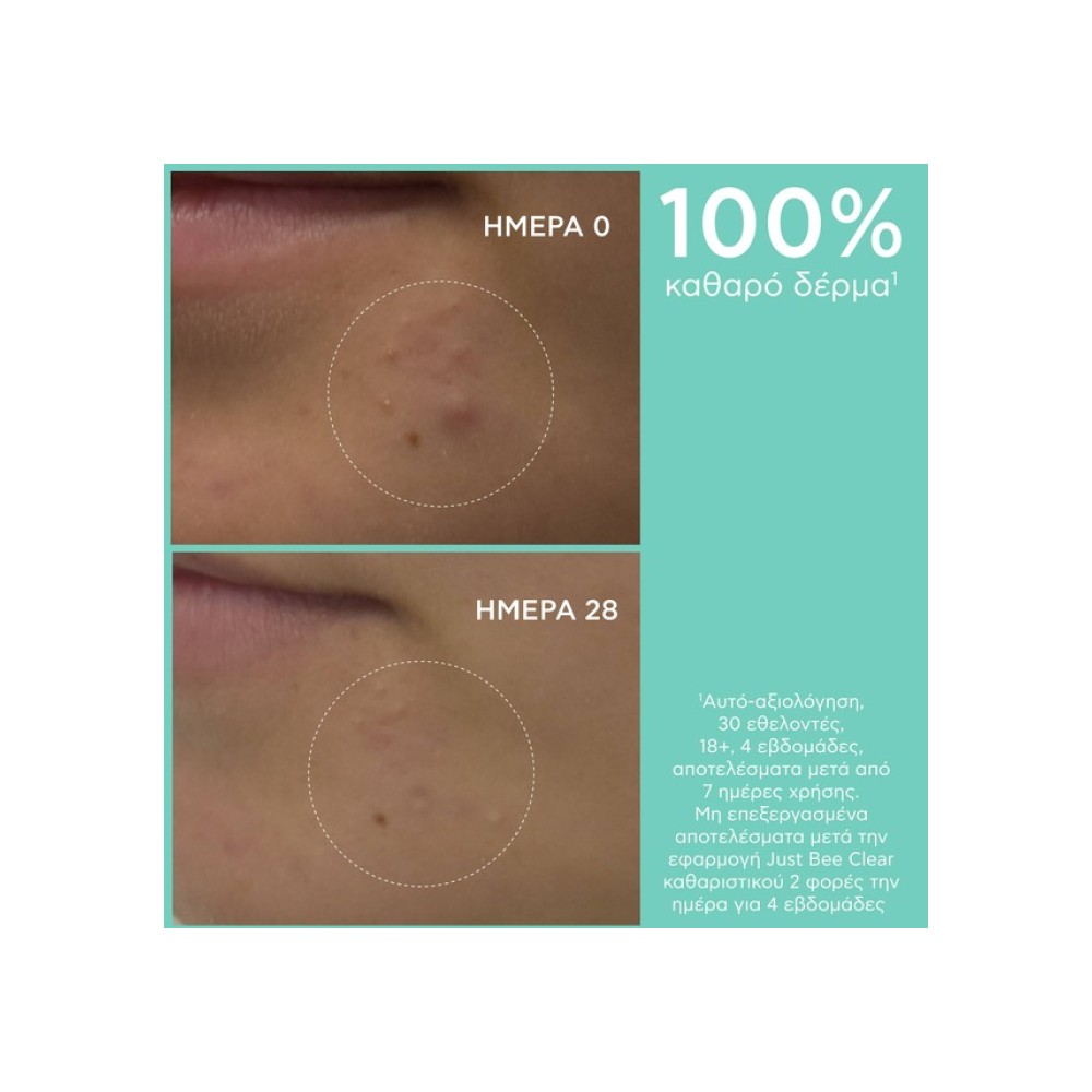 Preview 5 of Apivita Just Bee Clear Gel Καθαρισμού Με Πρόπολη AmC & Φυτικό Σαλικυλικό Οξύ 200ml.