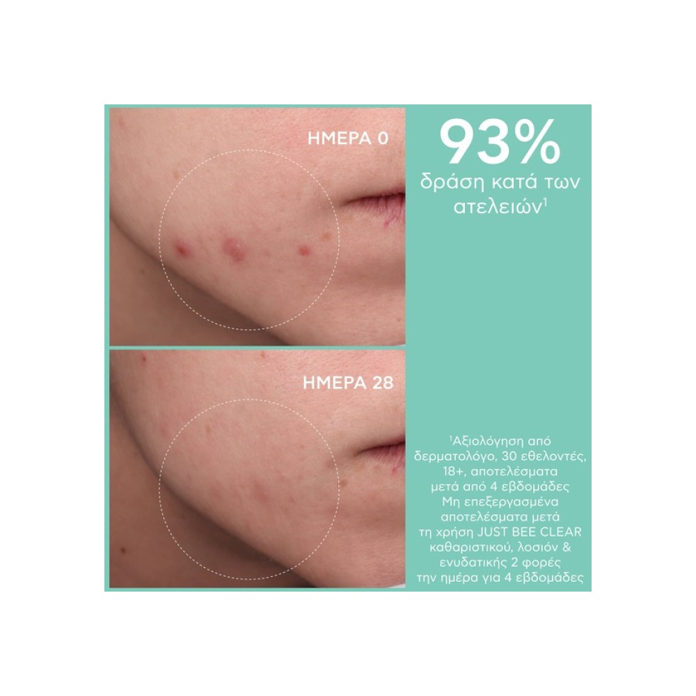 Preview 6 of Apivita Just Bee Clear Λοσιόν Σύσφιξης Πόρων Με Πρόπολη AmC & Φυτικό Σαλικυλικό Οξύ 200ml.