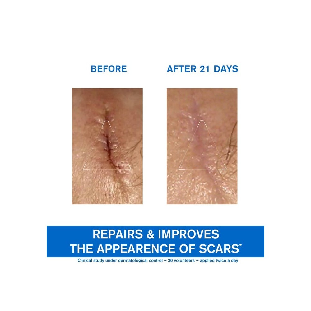 Preview 3 of Uriage Bariederm Cica Cream with Cu-Zn 100ml