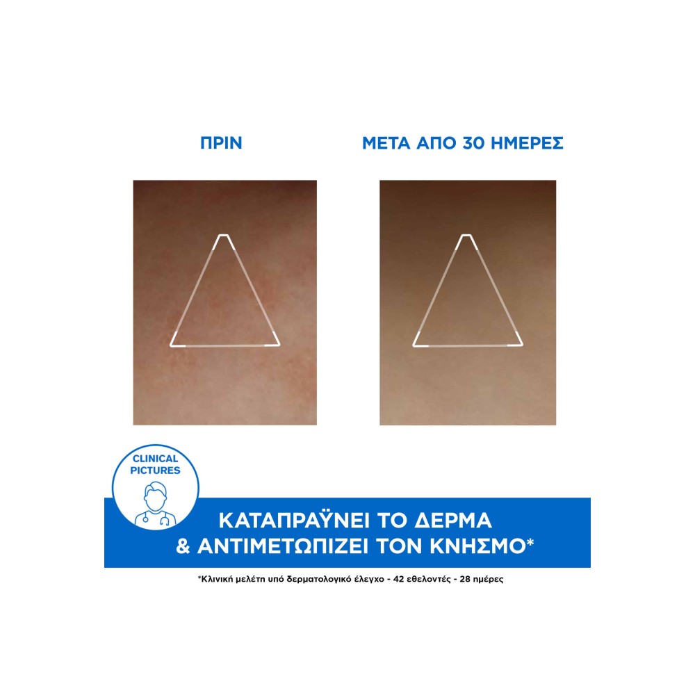 Preview 2 of Uriage Xemose Cerat Relipidant Anti Irritations 200ml - Κρέμα με καταπραυντική δράση για πολύ ξηρό και ατοπικό δέρμα