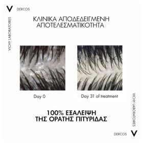 Preview 2 of Vichy Dercos Anti-Dandruff DS 2in1 - Σαμπουάν & Conditioner Κατά της Πιτυρίδας για Όλους τους Τύπους Μαλλιών 390ml