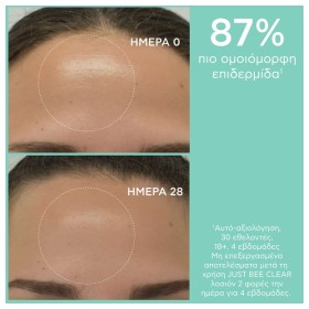 Apivita Just Bee Clear Λοσιόν Σύσφιξης Πόρων Με Πρόπολη AmC & Φυτικό Σαλικυλικό Οξύ 200ml. – φωτογραφία 5