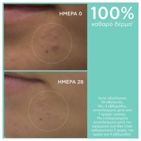 Apivita Just Bee Clear Gel Καθαρισμού Με Πρόπολη AmC & Φυτικό Σαλικυλικό Οξύ 200ml. – φωτογραφία 5