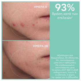 Apivita Just Bee Clear Λοσιόν Σύσφιξης Πόρων Με Πρόπολη AmC & Φυτικό Σαλικυλικό Οξύ 200ml. – φωτογραφία 6