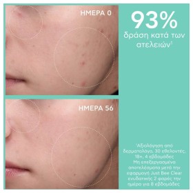 Preview 6 of Apivita Just Bee Clear Κρέμα Κατά Των Ατελειών Με Πρόπολη AmC & Φυτικό Σαλικυλικό Οξύ 40ml.