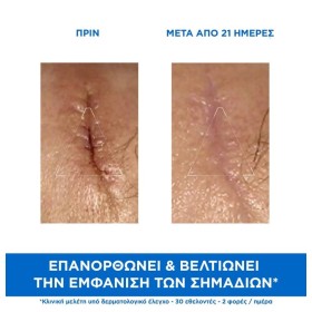Uriage Bariederm Cica-Creme Reparatrice 40ml – φωτογραφία 5