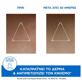 Preview 2 of Uriage Xemose Cerat Relipidant Anti Irritations 200ml - Κρέμα με καταπραυντική δράση για πολύ ξηρό και ατοπικό δέρμα