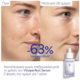 Preview 3 of Caudalie Vinoperfect Serum Eclat Anti-taches Ορός Λάμψης Κατά των Κηλίδων 30ml