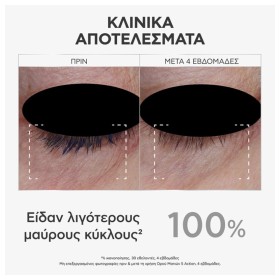 Apivita 5 Action Ενυδατικό & Αντιγηραντικό Serum Ματιών με Υαλουρονικό Οξύ & Κολλαγόνο για Μαύρους Κύκλους & Λάμψη 15ml – φωτογραφία 4